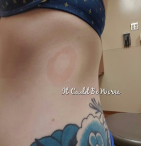 ER Deja Vu & Veterans Day Weekend It Could Be Worse