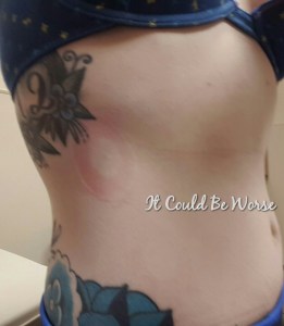 ER Deja Vu & Veterans Day Weekend It Could Be Worse