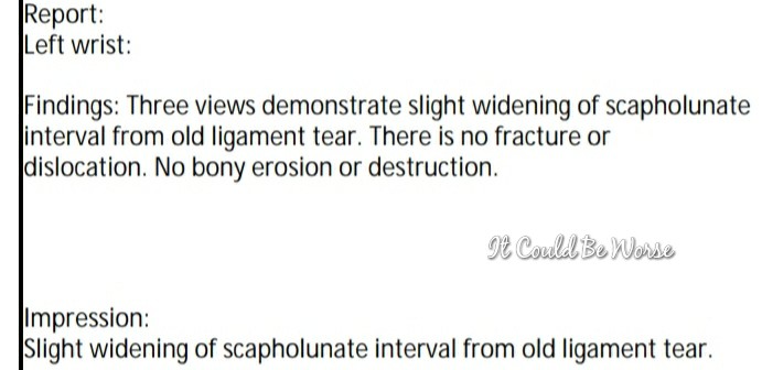 Lumpy, the Ganglion Cyst, A Trilogy - It Could Be Worse - Mary Horsley