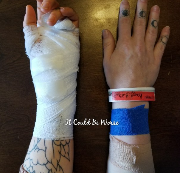 Ganglionectomy - It Could Be Worse Blog - Mary Horsley