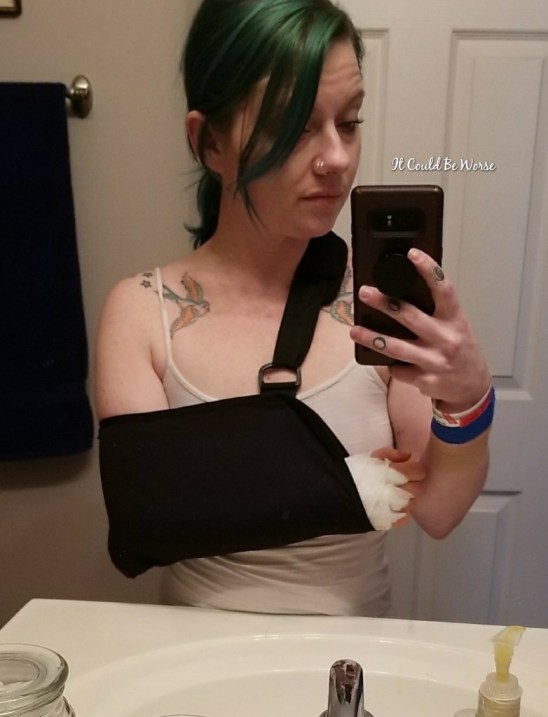 Ganglionectomy - It Could Be Worse Blog - Mary Horsley