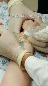 My Ganglion Cyst - The Tetralogy | IT COULD BE WORSE BLOG