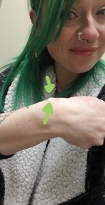 Lumpy, the Ganglion Cyst, A Trilogy - It Could Be Worse - Mary Horsley