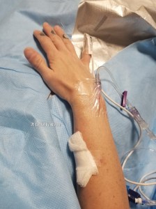 One Step Forward, Two Steps Back | IT COULD BE WORSE BLOG