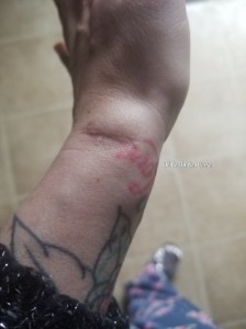 One Step Forward, Two Steps Back | IT COULD BE WORSE BLOG