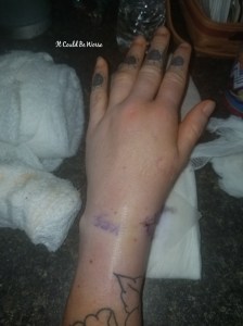 One Step Forward, Two Steps Back | IT COULD BE WORSE BLOG