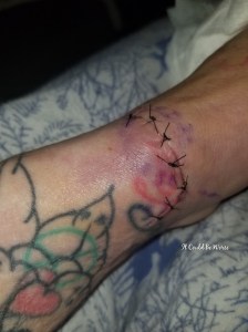 One Step Forward, Two Steps Back | IT COULD BE WORSE BLOG