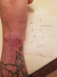 One Step Forward, Two Steps Back | IT COULD BE WORSE BLOG