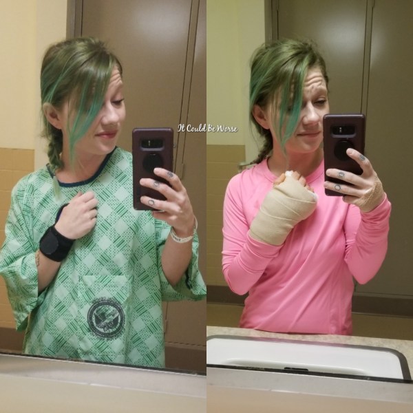 My Ganglion Cyst - The Tetralogy | IT COULD BE WORSE BLOG