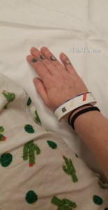 Rib Plating Surgery and Thoracic Appointments | IT COULD BE WORSE BLOG