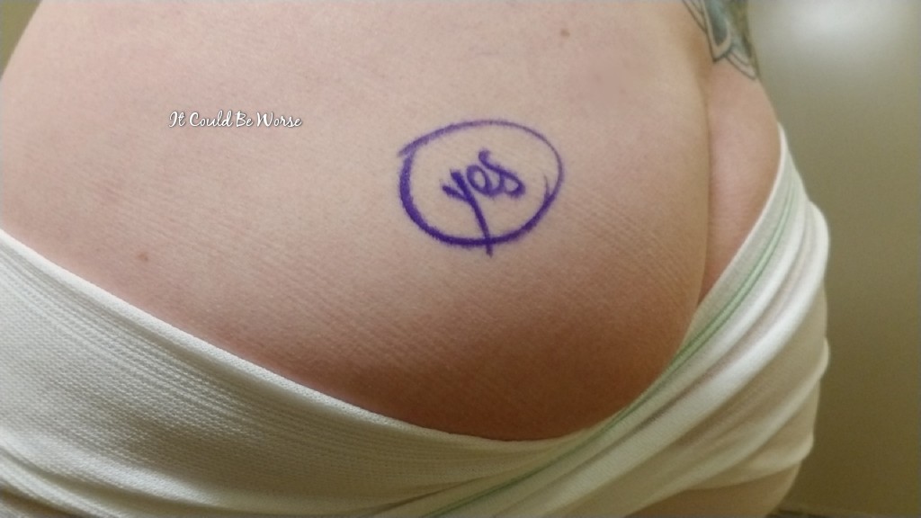 Perianal Abscess #2 in My Crohn's Disease Journey | IT COULD BE WORSE BLOG - Mary Horsley