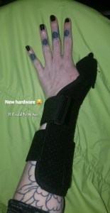 De Quervain's Tenosynovitis - Lefty | IT COULD BE WORSE BLOG