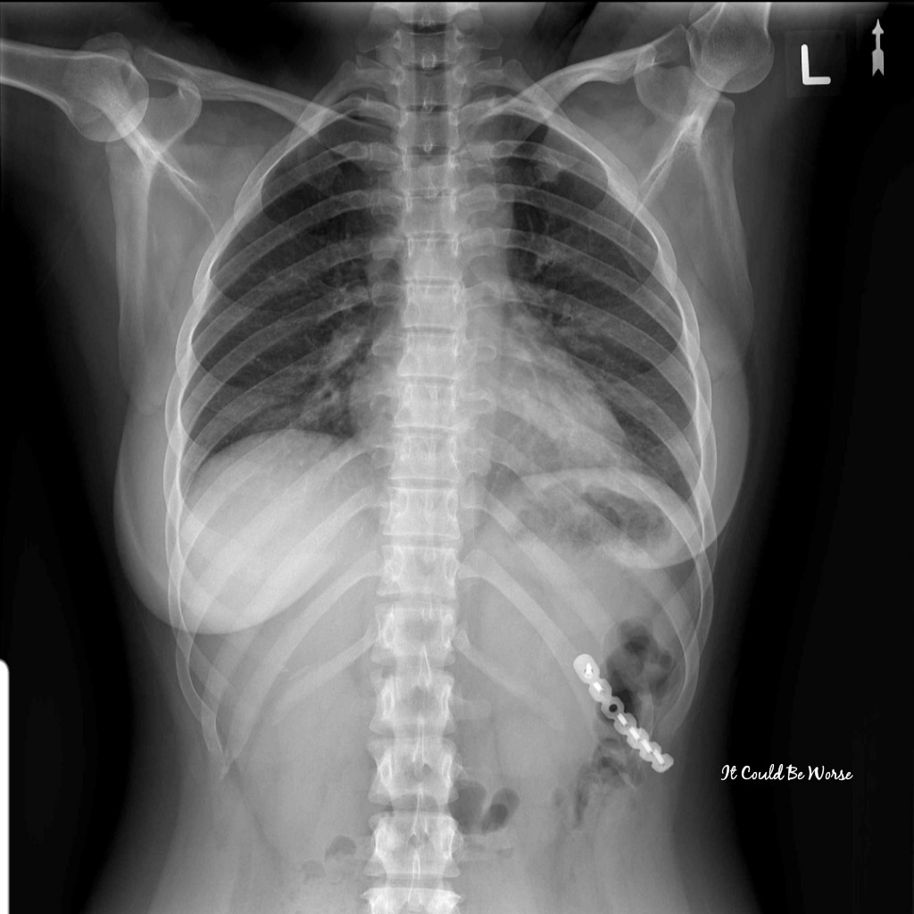 2020 Visions | IT COULD BE WORSE BLOG