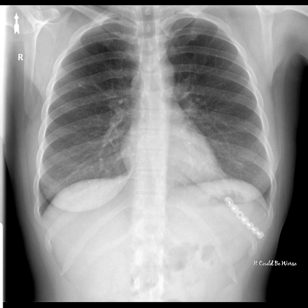 2020 Visions | IT COULD BE WORSE BLOG