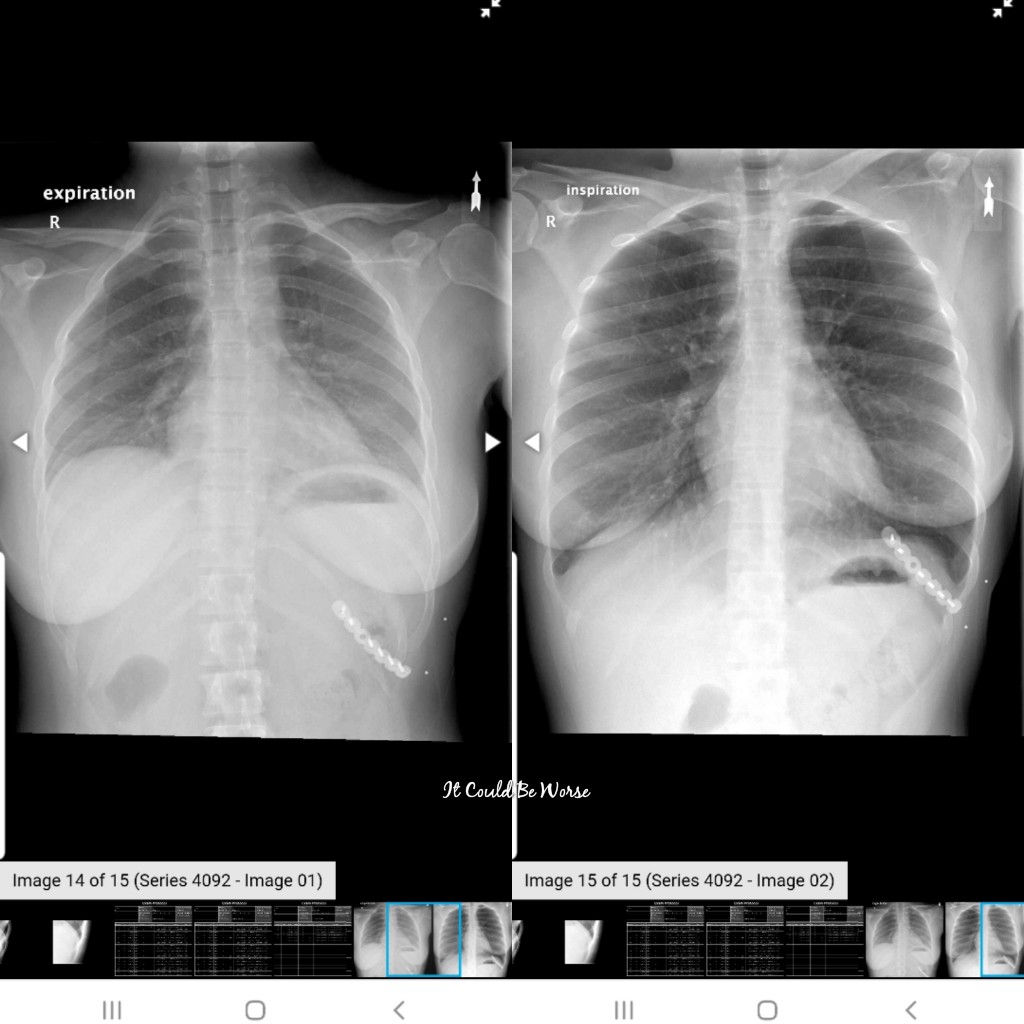 2020 Visions | IT COULD BE WORSE BLOG