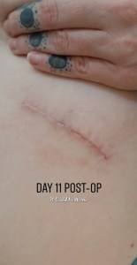 March Madness - Social Distancing | IT COULD BE WORSE BLOG