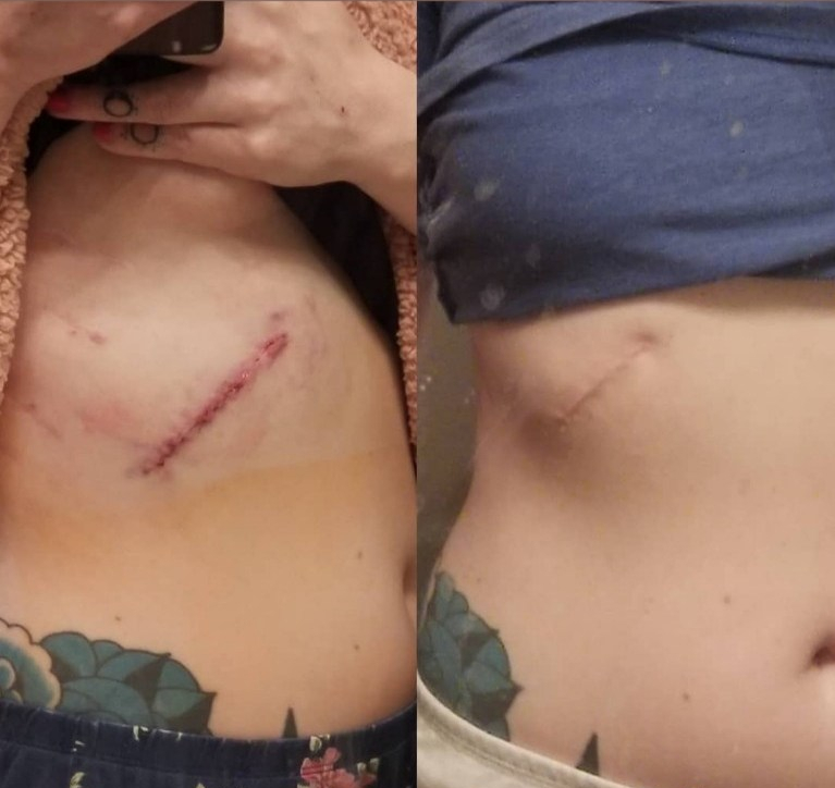 Any Way You Slice It - Thoracic & Hand Surgery, Again