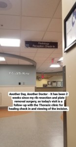 Slipping Rib Syndrome | IT COULD BE WORSE BLOG