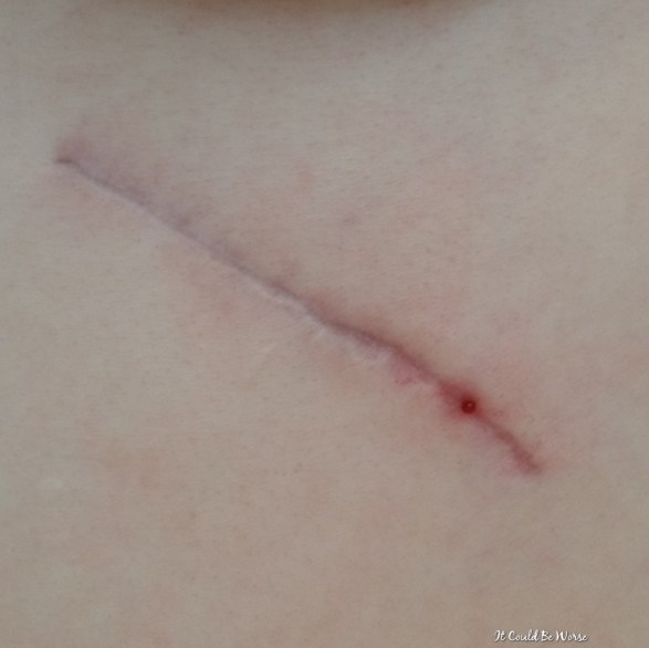 March Madness - Social Distancing | IT COULD BE WORSE BLOG