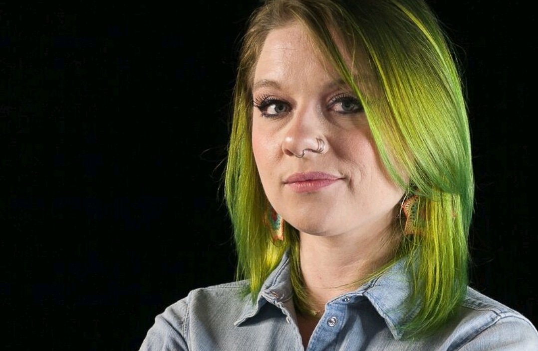 3 Months Post-Op Slipping Rib Syndrome