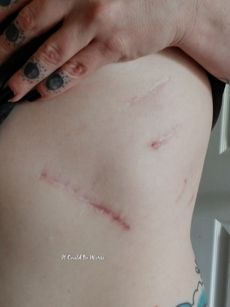 Any Way You Slice It - Thoracic & Hand Surgery, Again