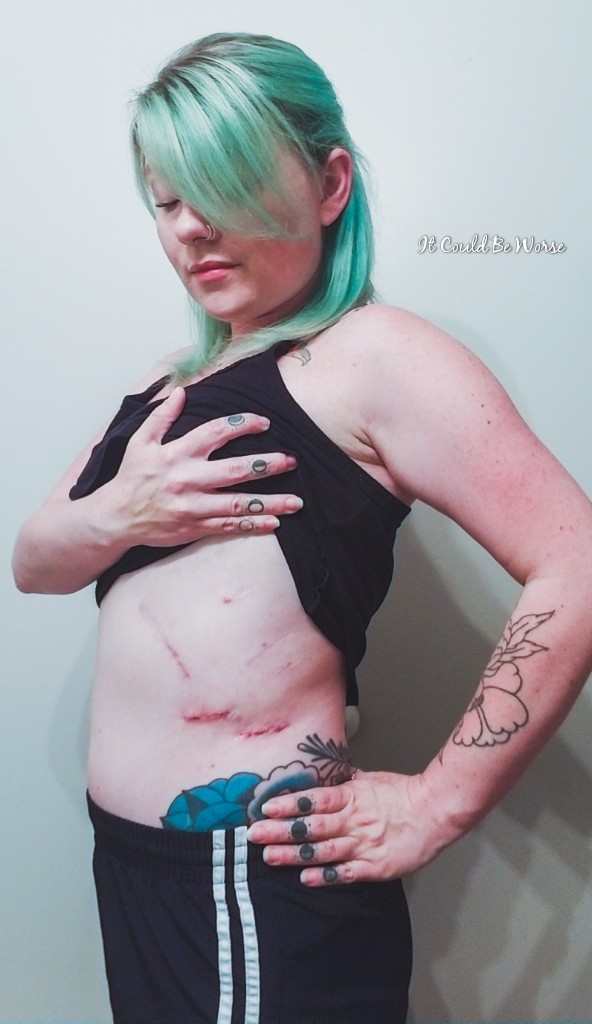 Seven Scars & My 10th Procedure