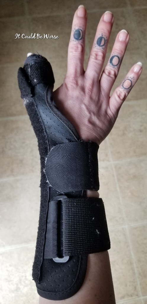 Seven Scars & My 10th Procedure