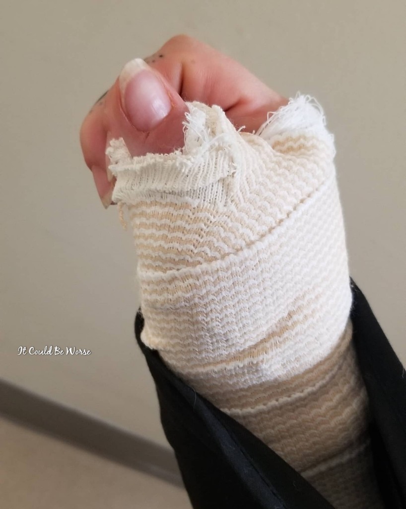 Seven Scars & My 10th Procedure