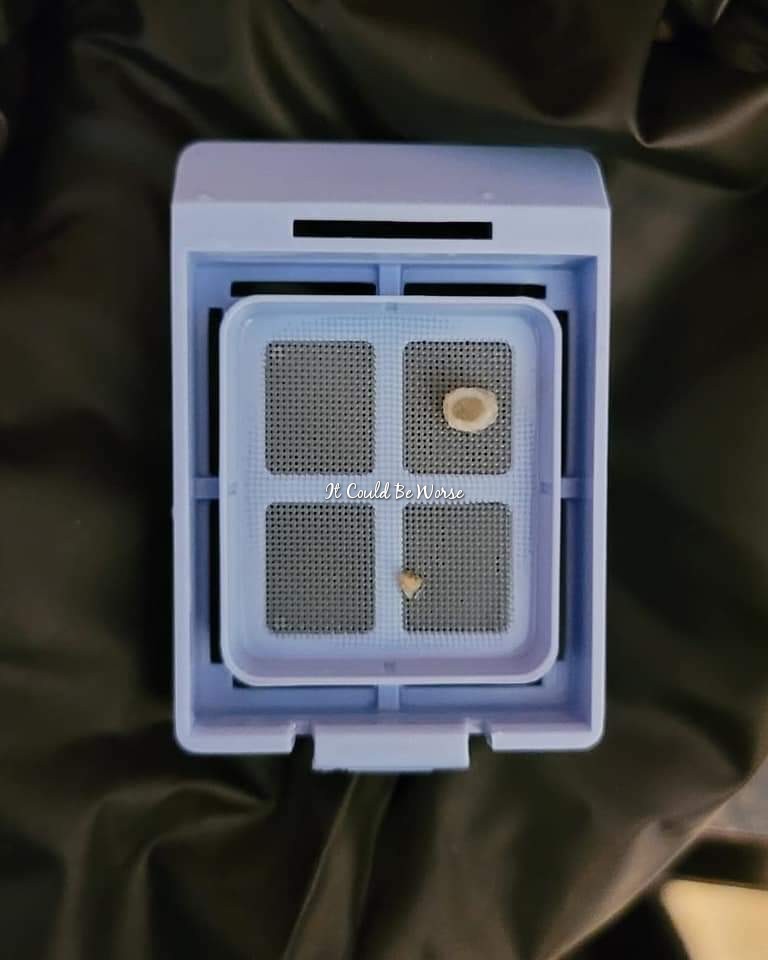 3 Years & 5 Surgeries- Slipping Rib Syndrome It Could Be Worse Blog Mary Horsley