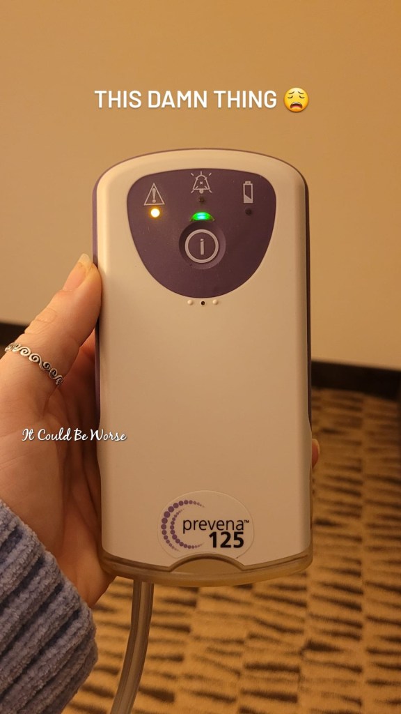 Slipping Rib Syndrome - Hansen Technique & One Month Follow-Up