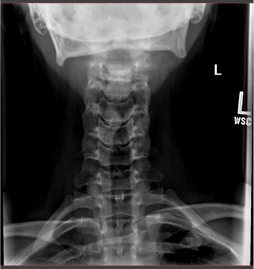 Pain in the Neck - It Could Be Worse